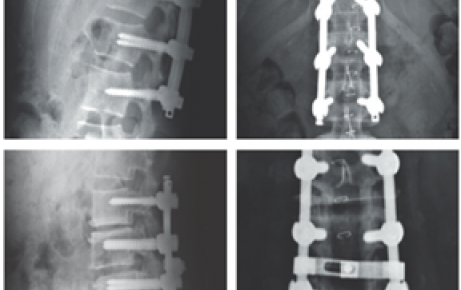 Hệ thống cột sống